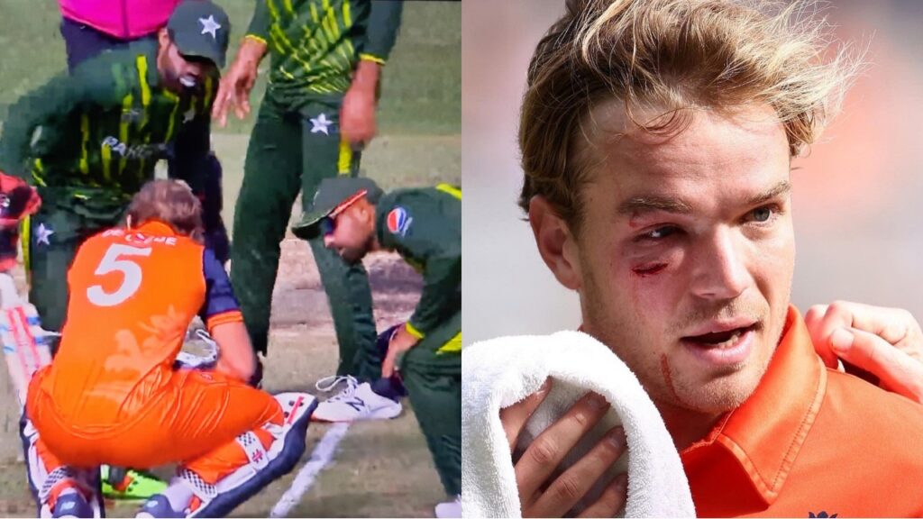 Bas de Leede suffers injury as Haris Rauf's bouncer hit him on face.