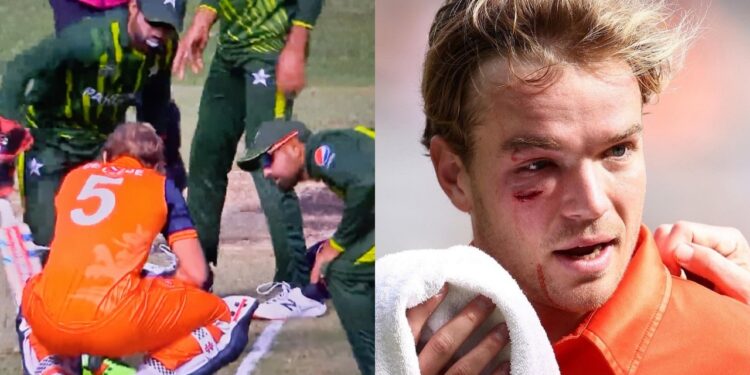 Bas de Leede suffers injury as Haris Rauf's bouncer hit him on face.